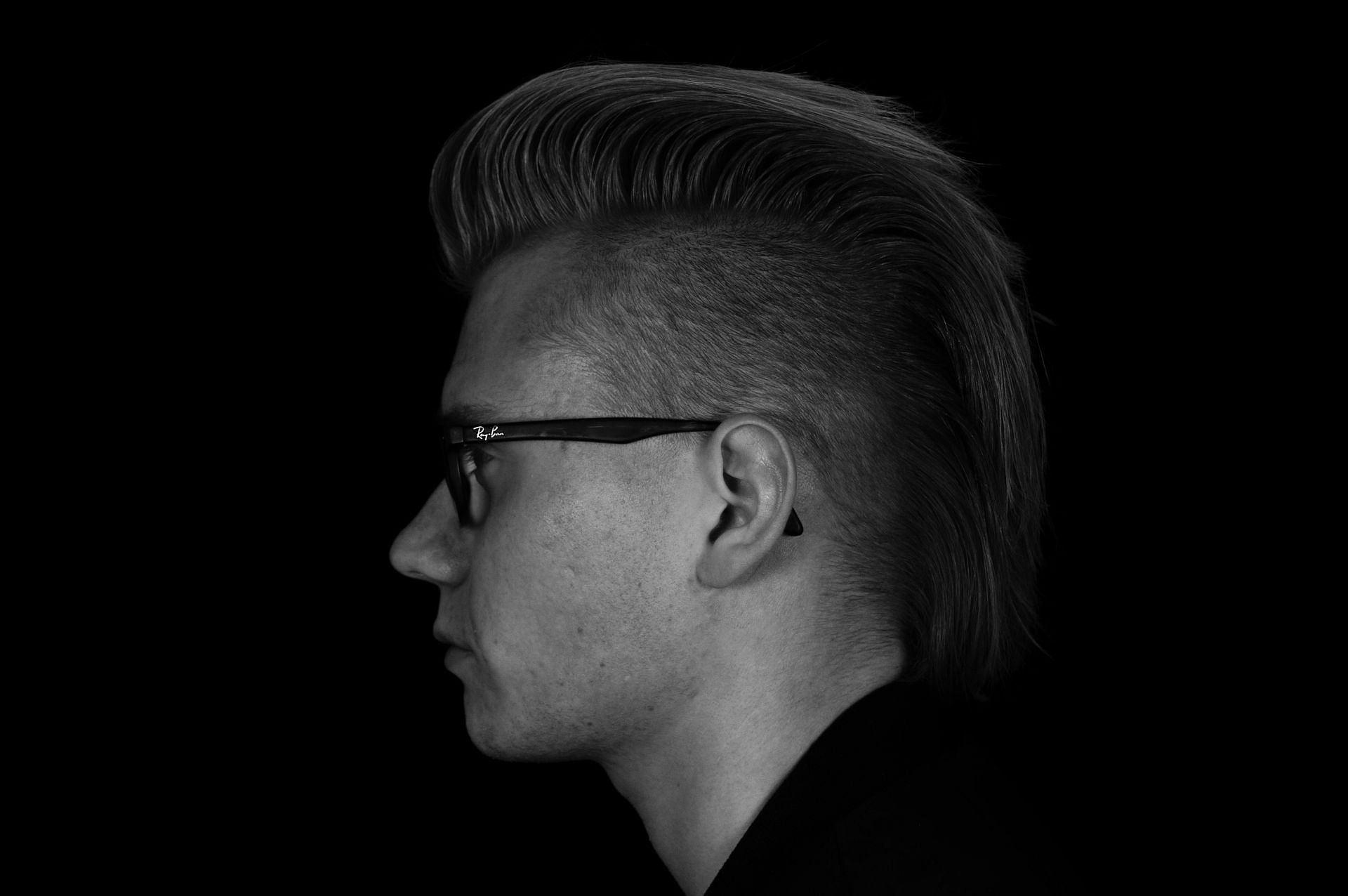 Teenage Hair Loss (Image via Unsplash/Hannes Wolf)